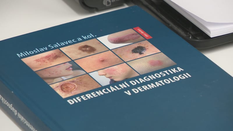 Lupénka a plísně ničí Čechům zdraví. Napadají i vnitřní orgány, varuje před nebezpečím lékař